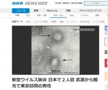 波多黎各-日本发现第二例新型肺炎确诊病例 患者系武汉游客