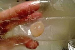 并不是吃了药以后就完事了
-深圳空派